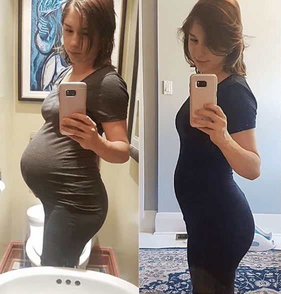 Mikhaila Peterson Before And After Pregnant